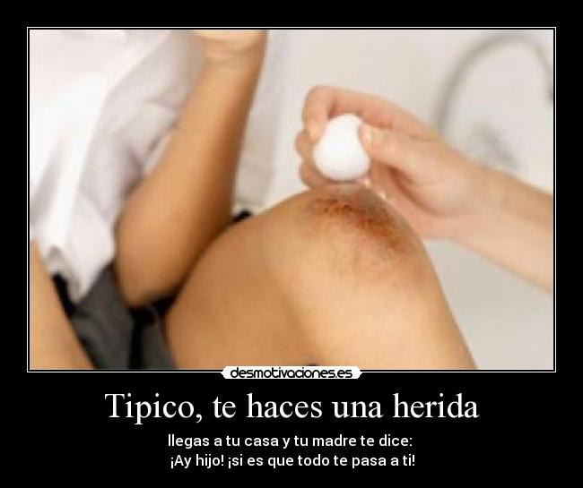 Tipico, te haces una herida -