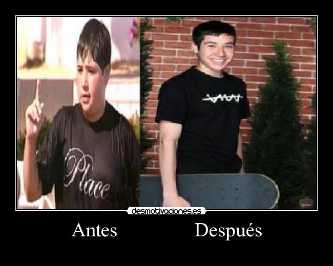 Antes Después -