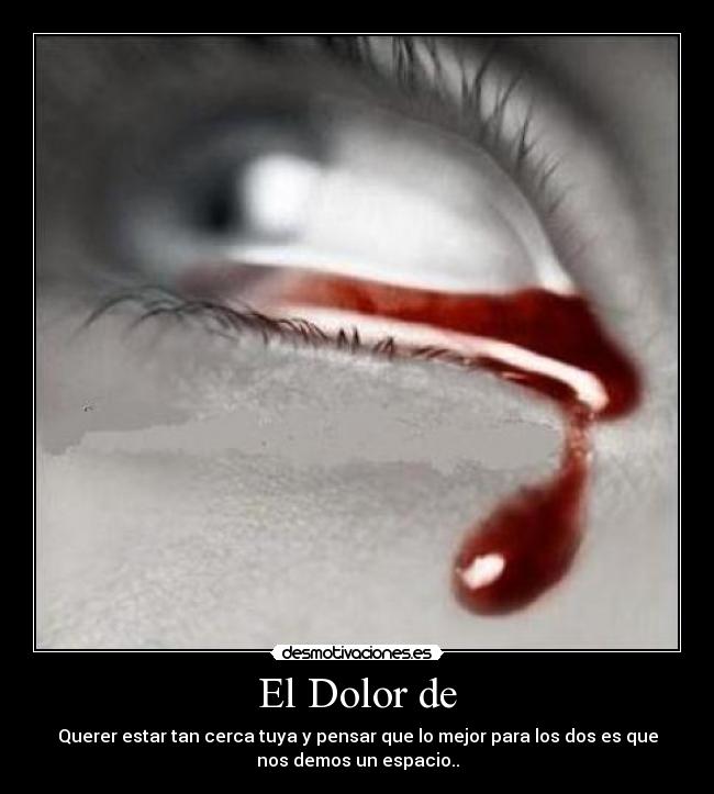 El Dolor de - 