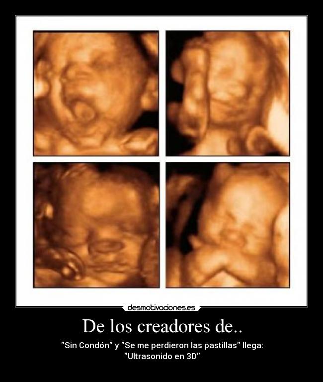 carteles bebe condonultrasonidodesmotivacionesetc desmotivaciones