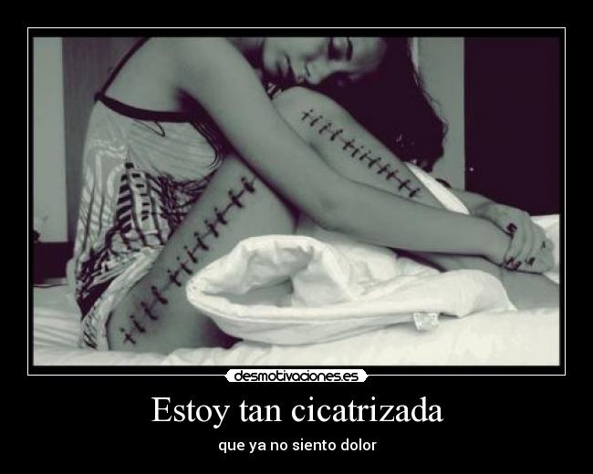 Estoy tan cicatrizada -