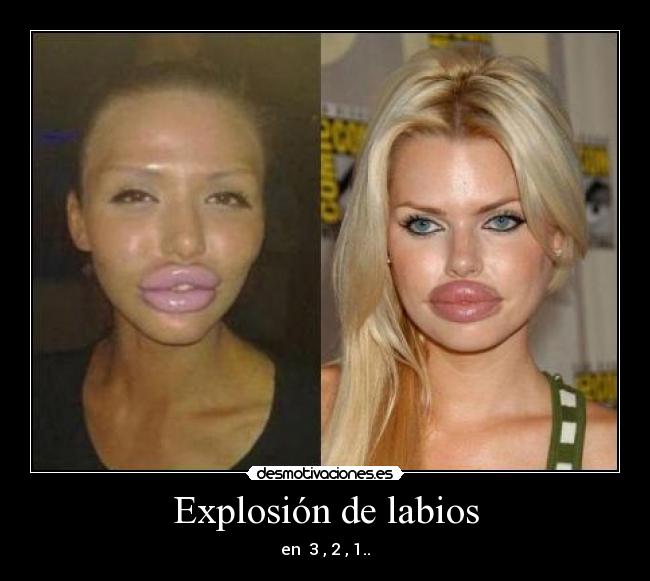 Explosión de labios -