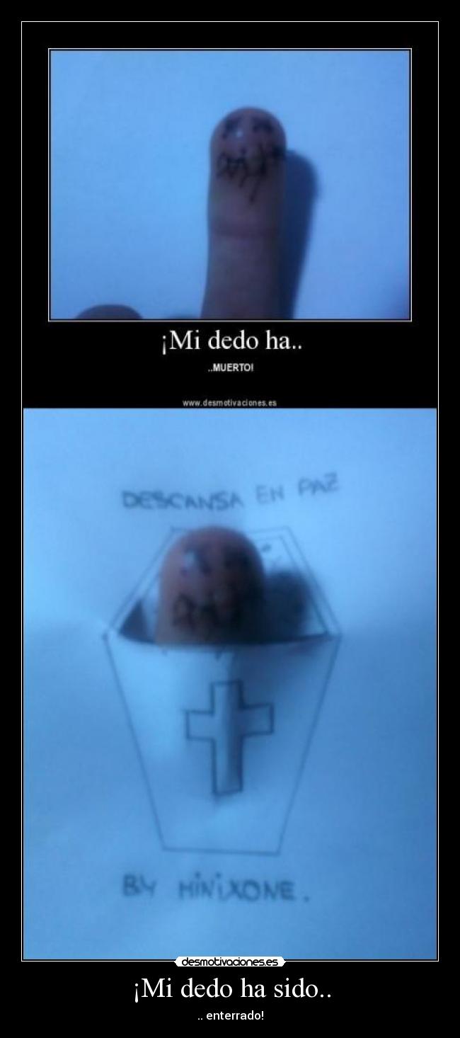¡Mi dedo ha sido.. - 