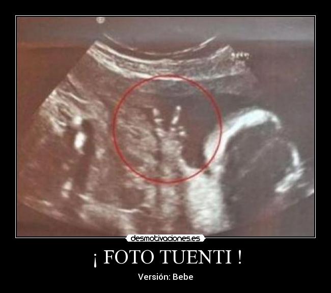 ¡ FOTO TUENTI ! -