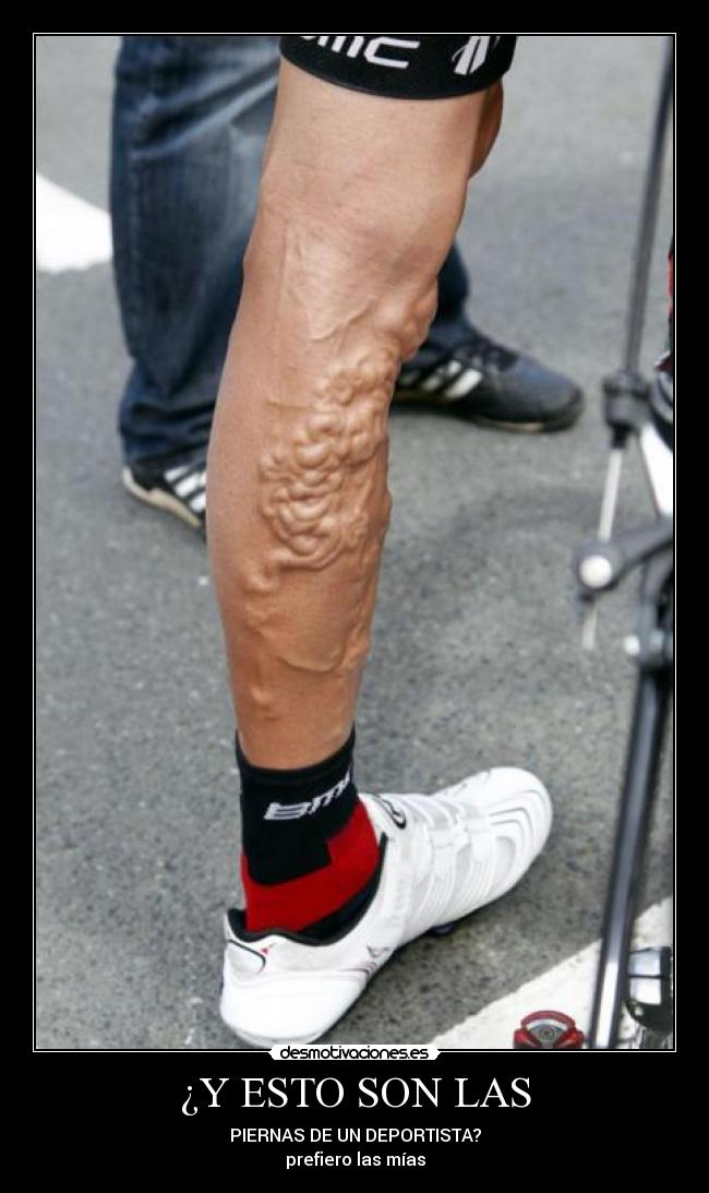 ¿Y ESTO SON LAS - PIERNAS DE UN DEPORTISTA?
prefiero las mías