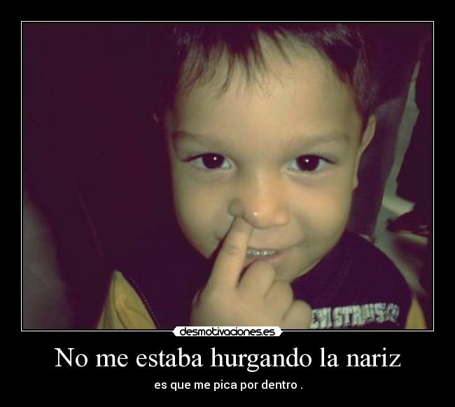 No me estaba hurgando la nariz - es que me pica por dentro .