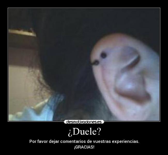 ¿Duele? - 