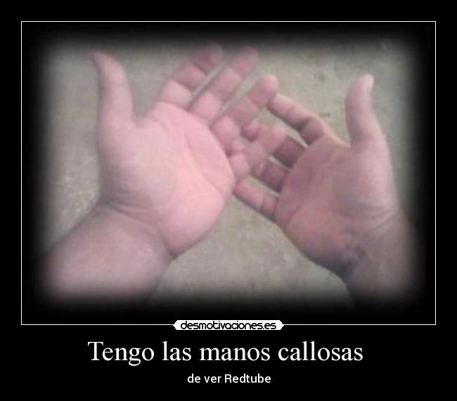 Tengo las manos callosas - de ver Redtube