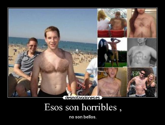 Esos son horribles , -