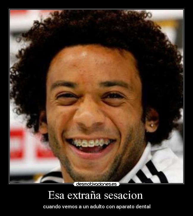 Esa extraña sesacion -