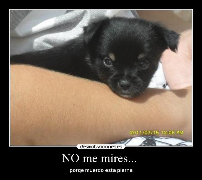 NO me mires... - porqe muerdo esta pierna