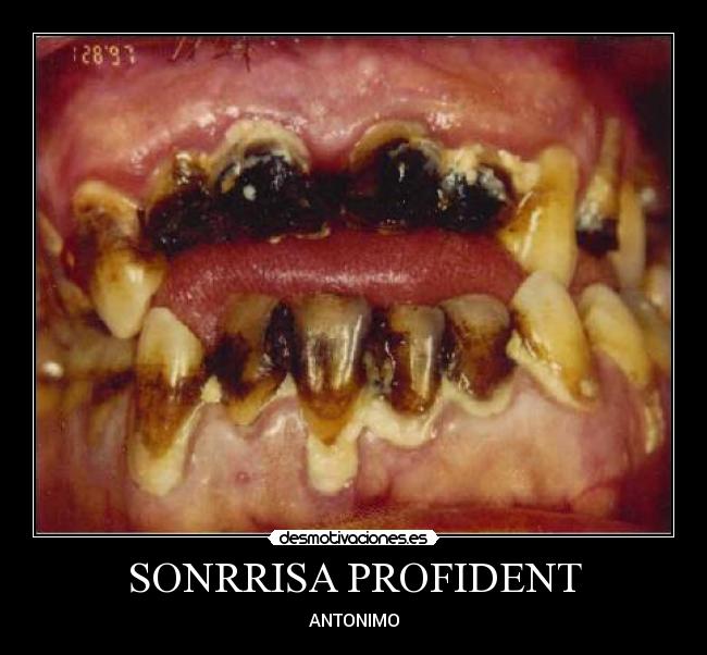 SONRRISA PROFIDENT - ANTONIMO