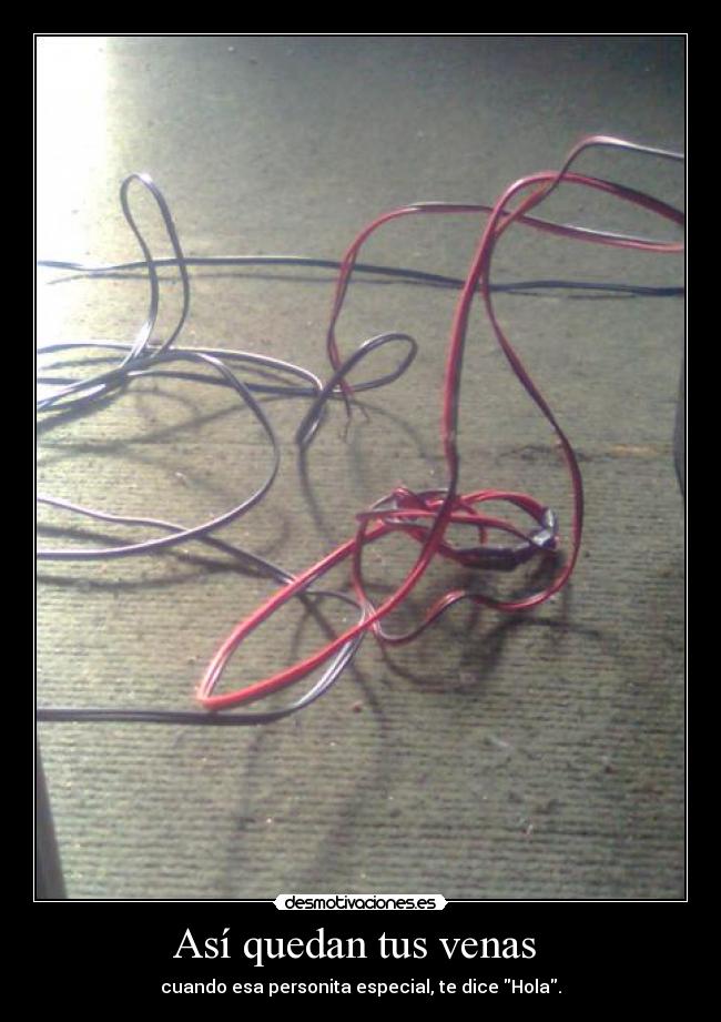 Así quedan tus venas - cuando esa personita especial, te dice Hola.