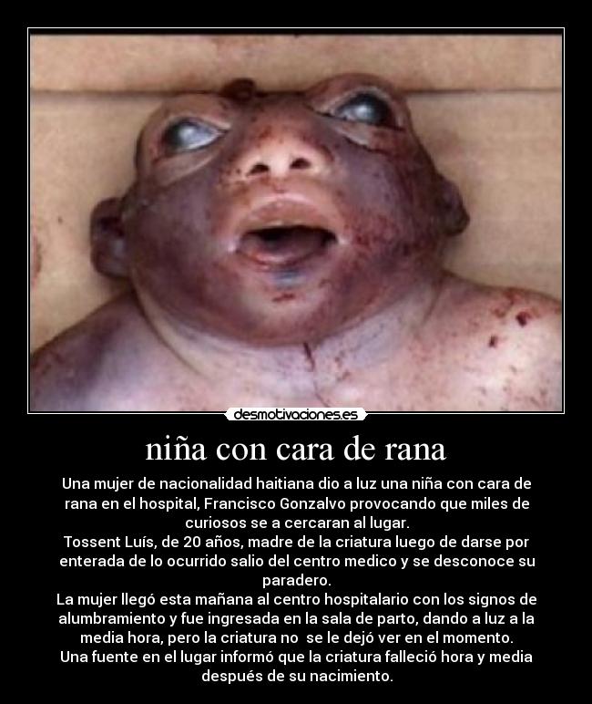 niña con cara de rana - 