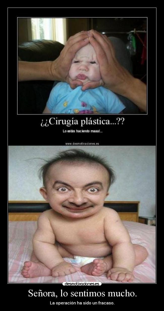 Señora, lo sentimos mucho. - La operación ha sido un fracaso.