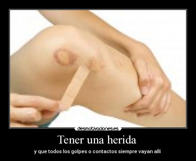 Tener una herida  - 