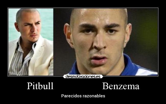 Pitbull Benzema -