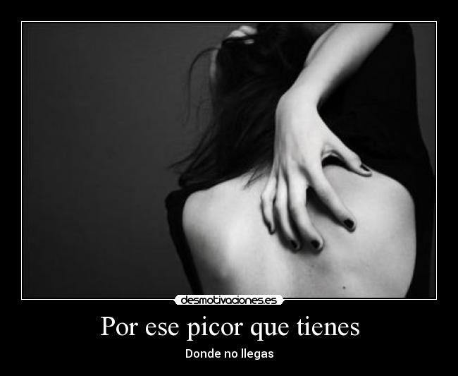 Por ese picor que tienes - 