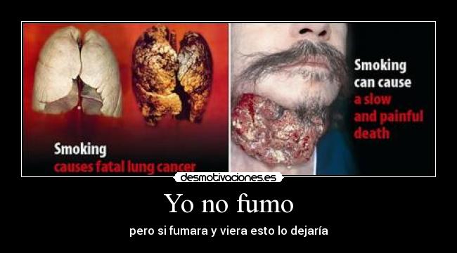 Yo no fumo -