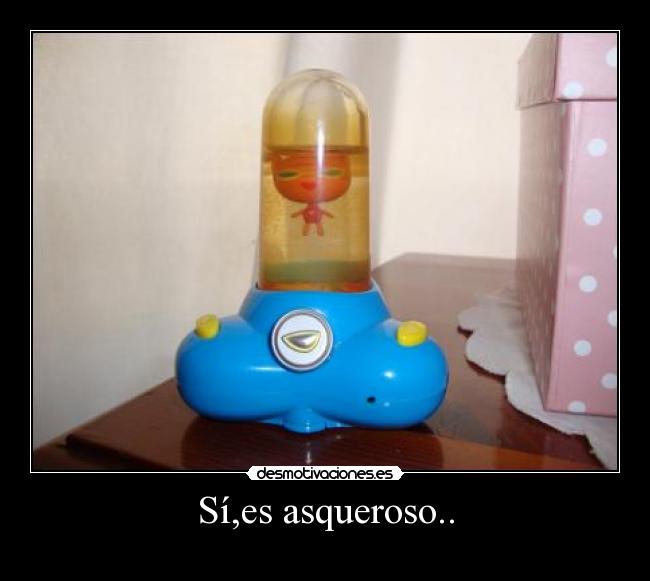 Sí,es asqueroso.. -