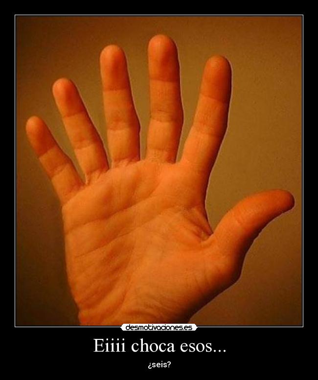 Eiiii choca esos... - ¿seis?