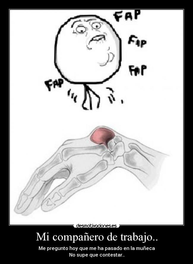 Mi compañero de trabajo.. - Me pregunto hoy que me ha pasado en la muñeca
No supe que contestar..