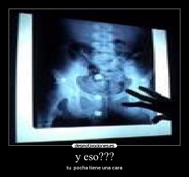 y eso??? - tu  pocha tiene una cara