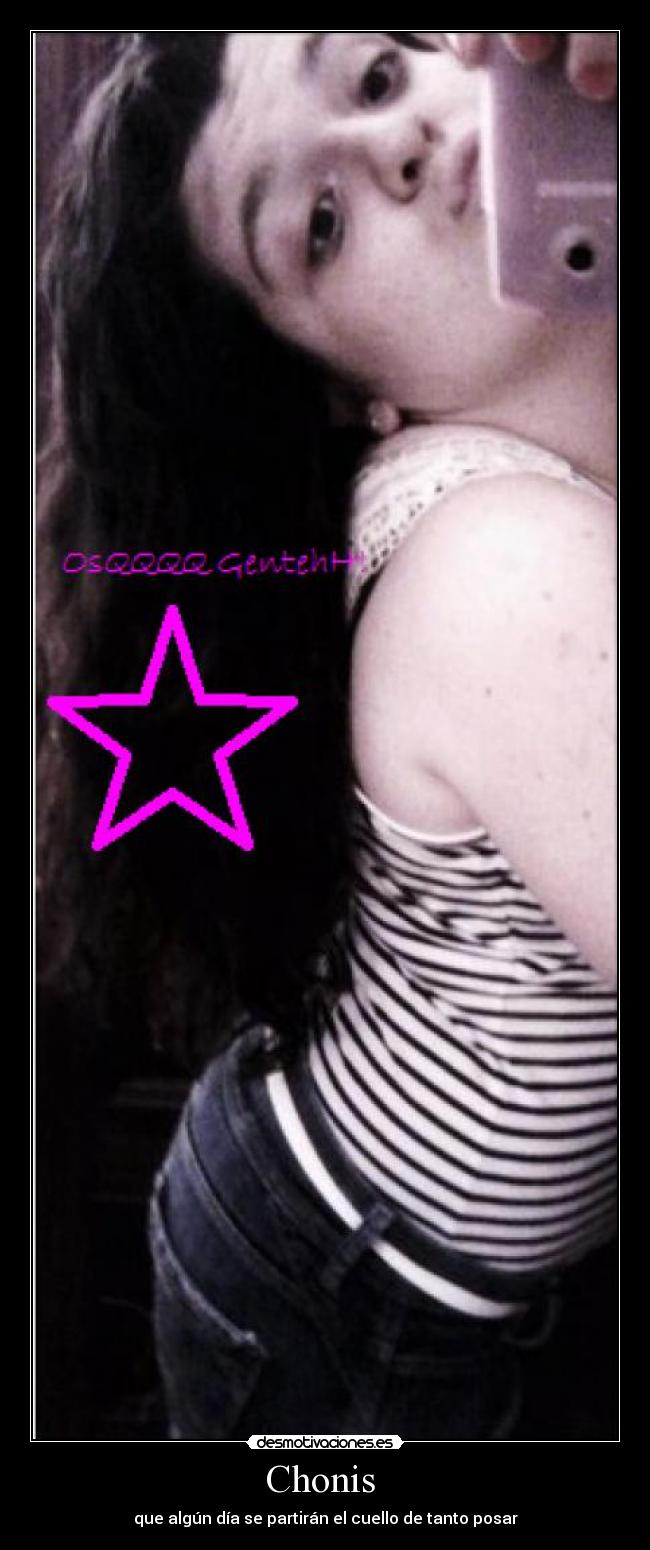 Chonis - que algún día se partirán el cuello de tanto posar