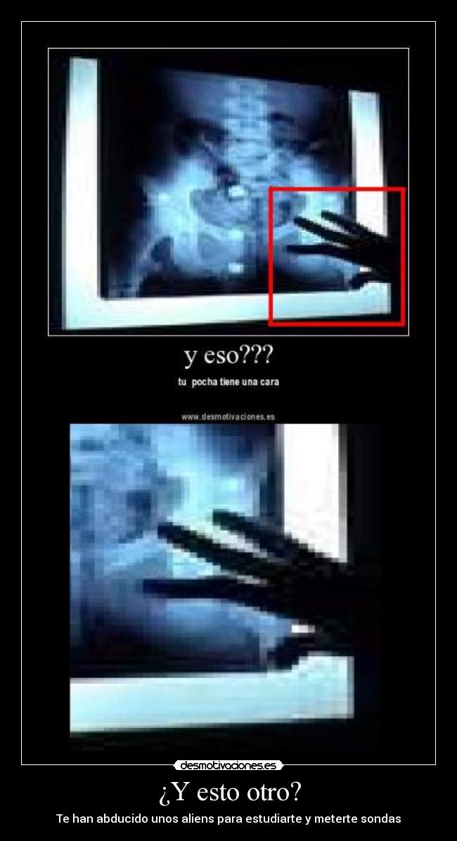 ¿Y esto otro? - Te han abducido unos aliens para estudiarte y meterte sondas