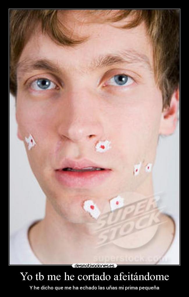 Yo tb me he cortado afeitándome - 