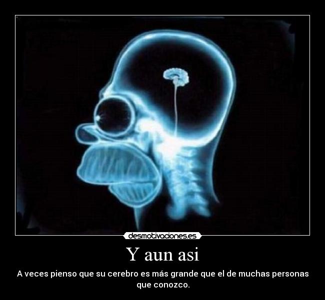 Y aun asi - A veces pienso que su cerebro es más grande que el de muchas personas
que conozco.