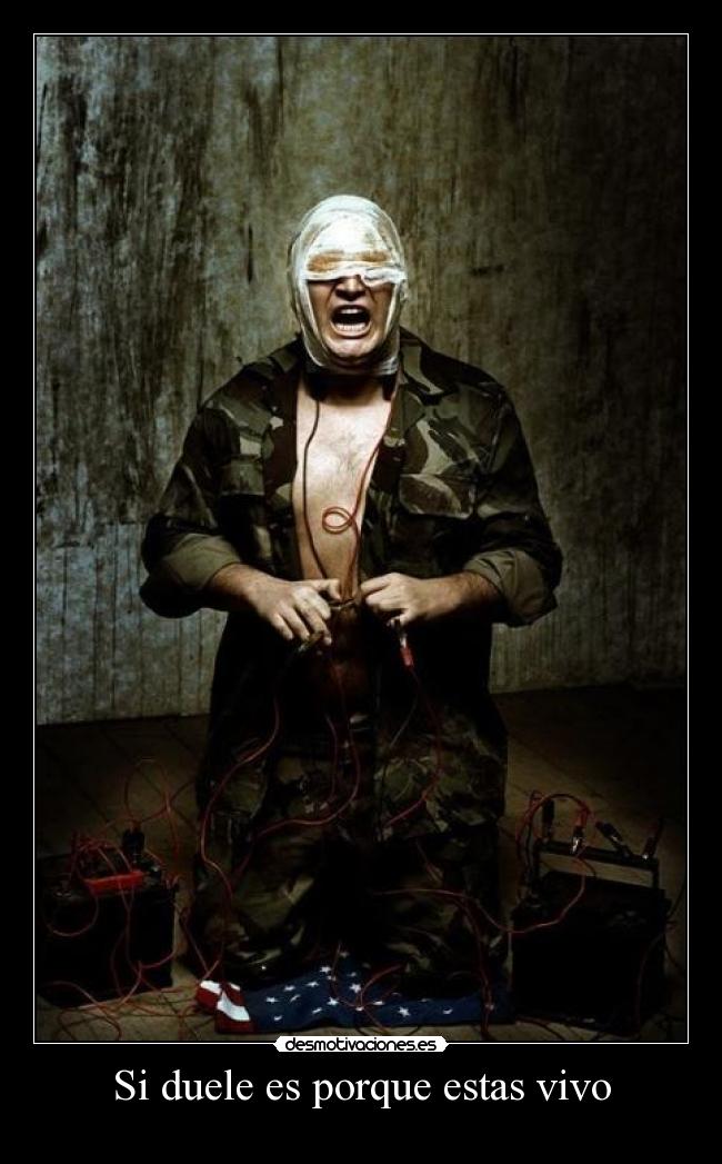 Si duele es porque estas vivo - 