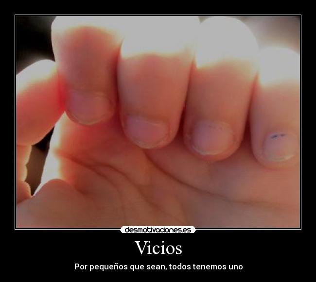 Vicios -