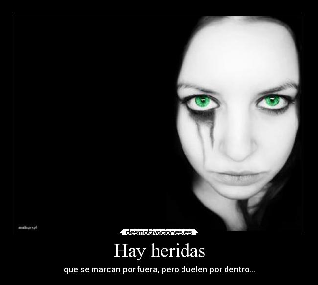 Hay heridas - que se marcan por fuera, pero duelen por dentro...