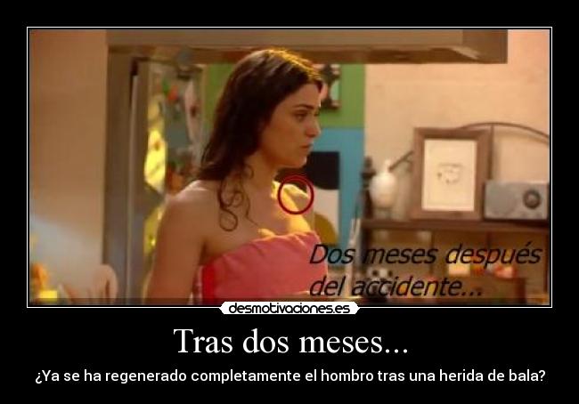 Tras dos meses... - ¿Ya se ha regenerado completamente el hombro tras una herida de bala?