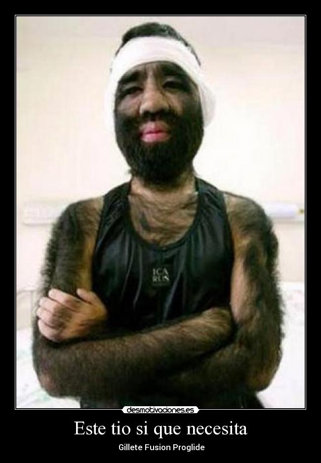 Este tio si que necesita -