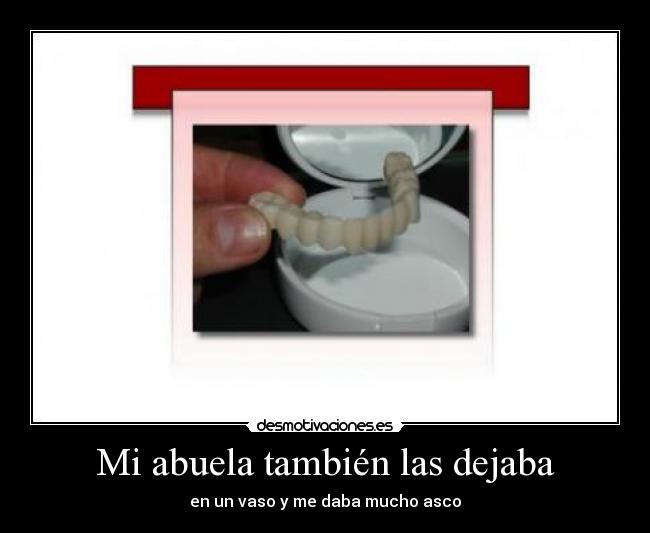 Mi abuela también las dejaba - en un vaso y me daba mucho asco