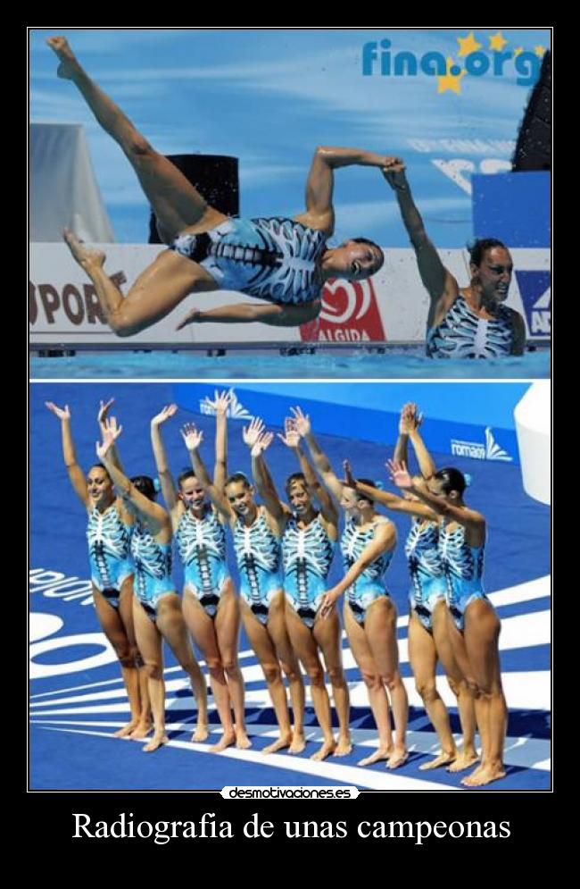 Radiografia de unas campeonas -