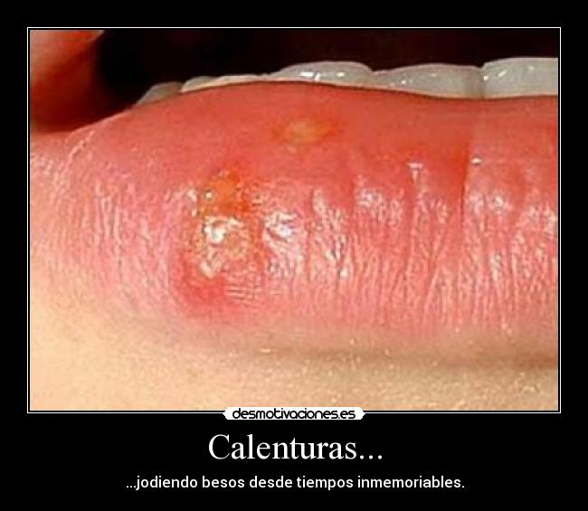 Calenturas... - ...jodiendo besos desde tiempos inmemoriables.