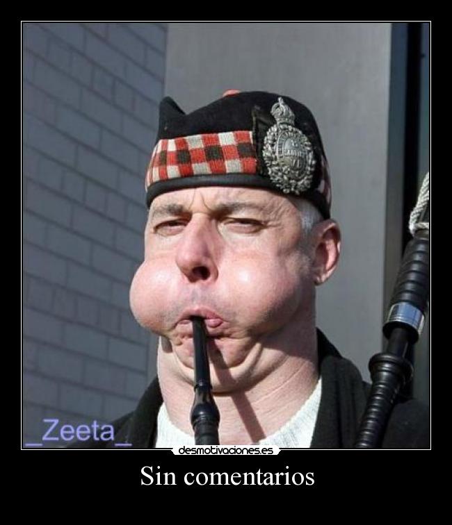 Sin comentarios - 