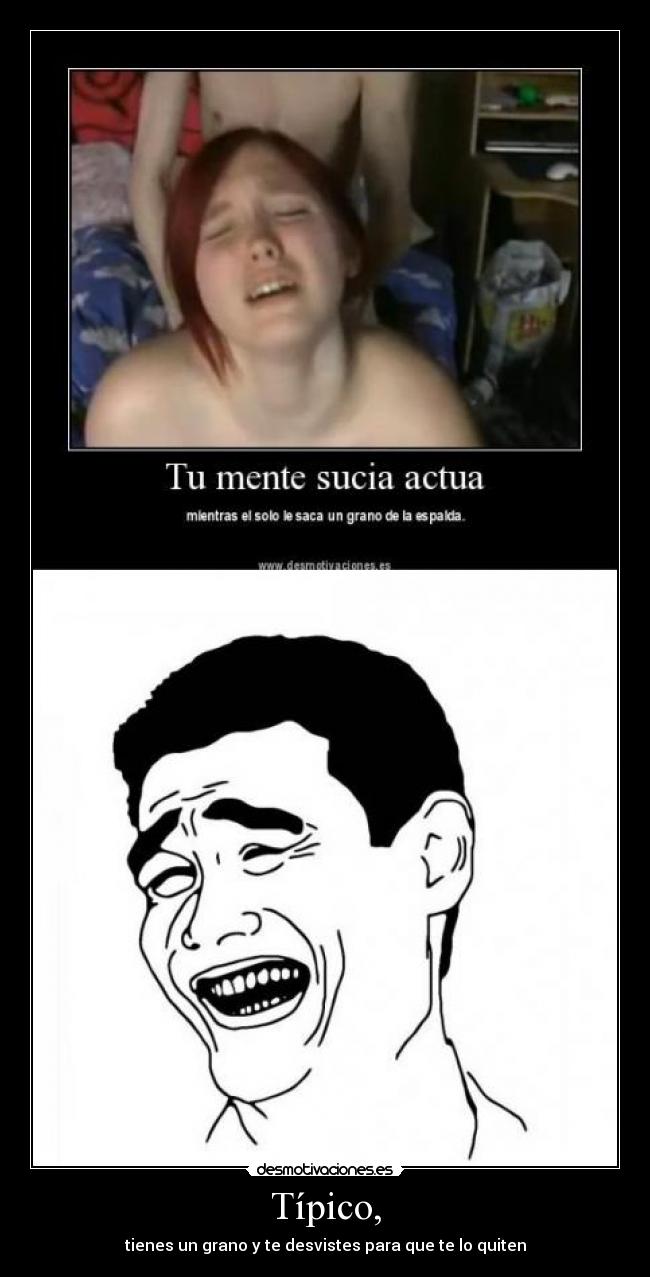 Típico, - tienes un grano y te desvistes para que te lo quiten