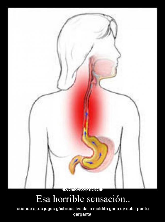 Esa horrible sensación.. - cuando a tus jugos gástricos les da la maldita gana de subir por tu garganta