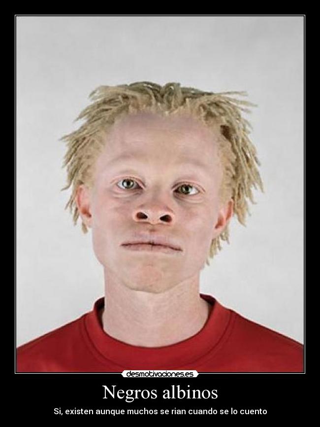 Negros albinos - 