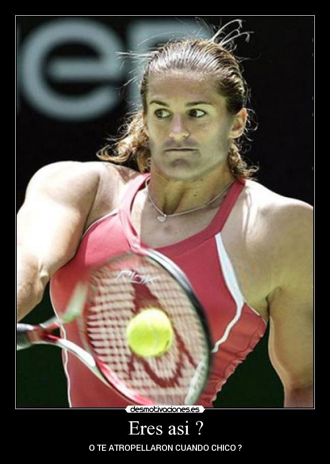 Eres asi ? - O TE ATROPELLARON CUANDO CHICO ?