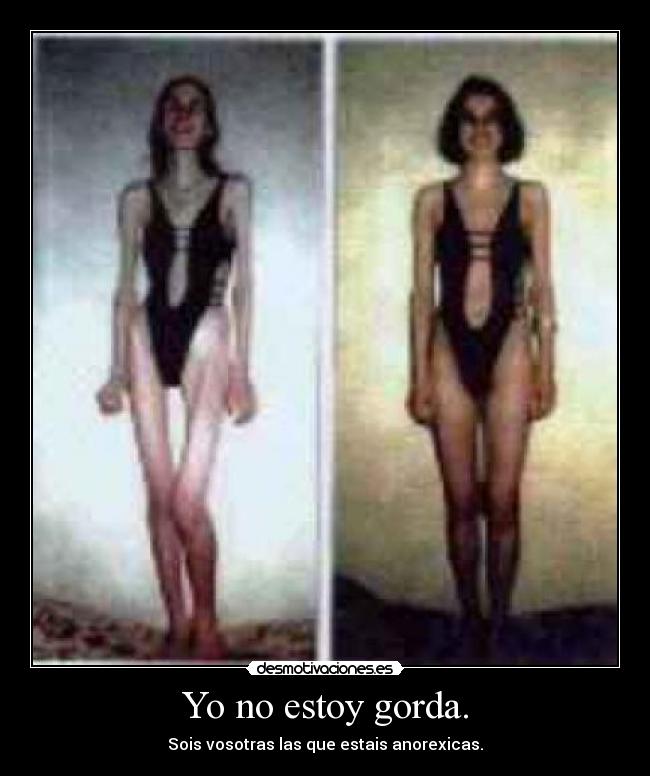 carteles anorexia desmotivaciones