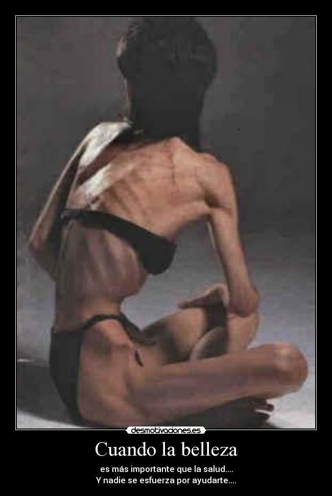 Cuando la belleza - es más importante que la salud....
Y nadie se esfuerza por ayudarte....
