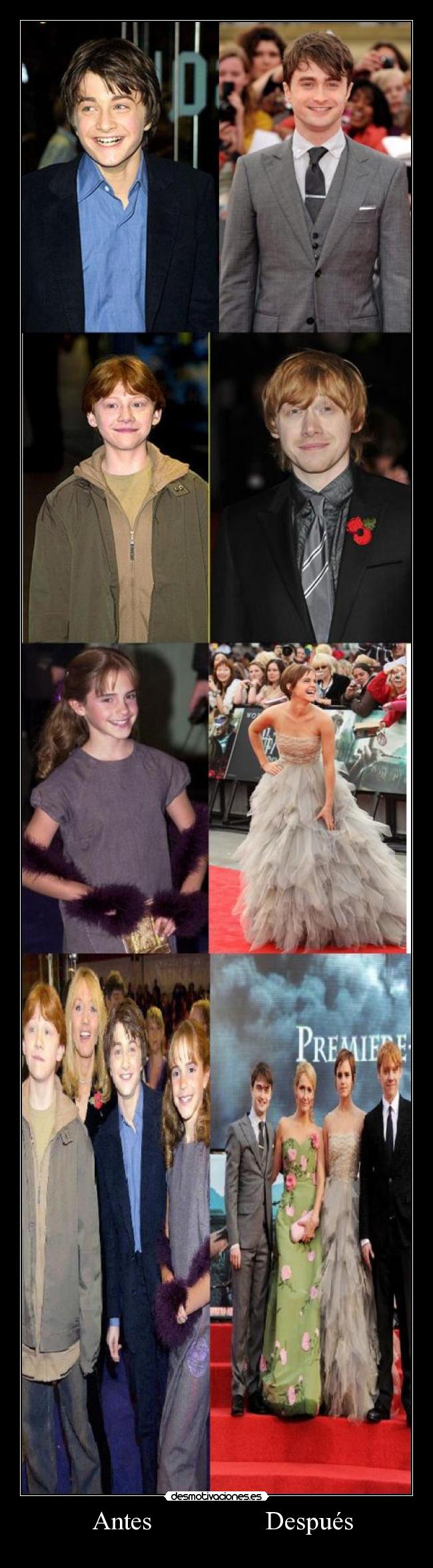   Antes                 Después - 