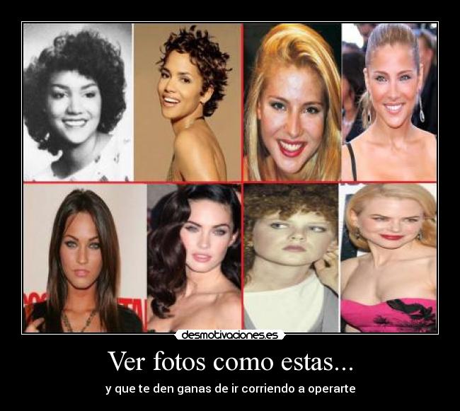 Ver fotos como estas... - y que te den ganas de ir corriendo a operarte