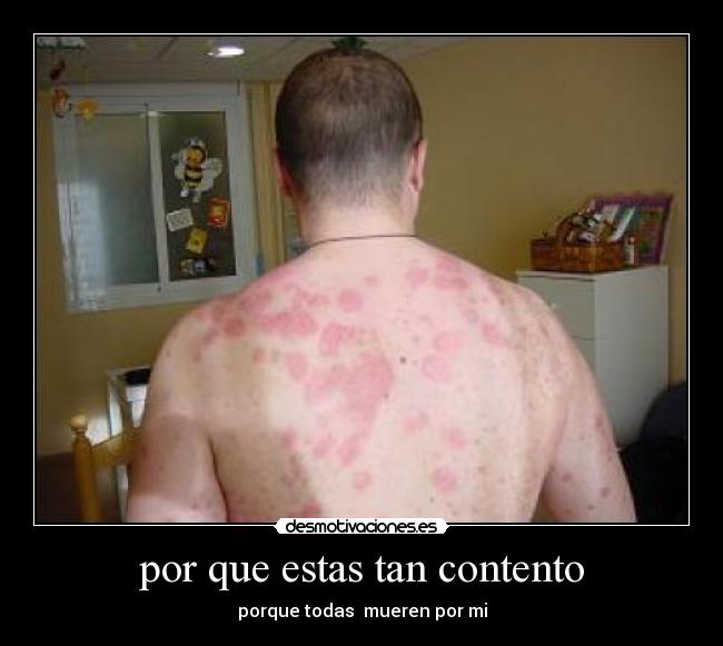 por que estas tan contento - porque todas mueren por mi