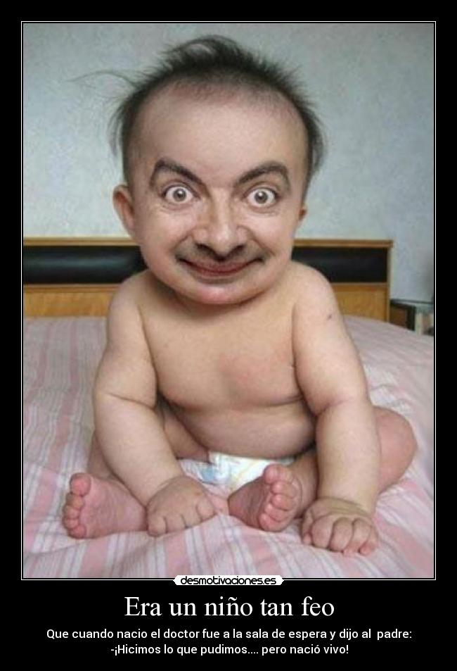 Era un niño tan feo - Que cuando nacio el doctor fue a la sala de espera y dijo al  padre:
-¡Hicimos lo que pudimos.... pero nació vivo!